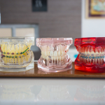 North York Dentist M3H 5Y4